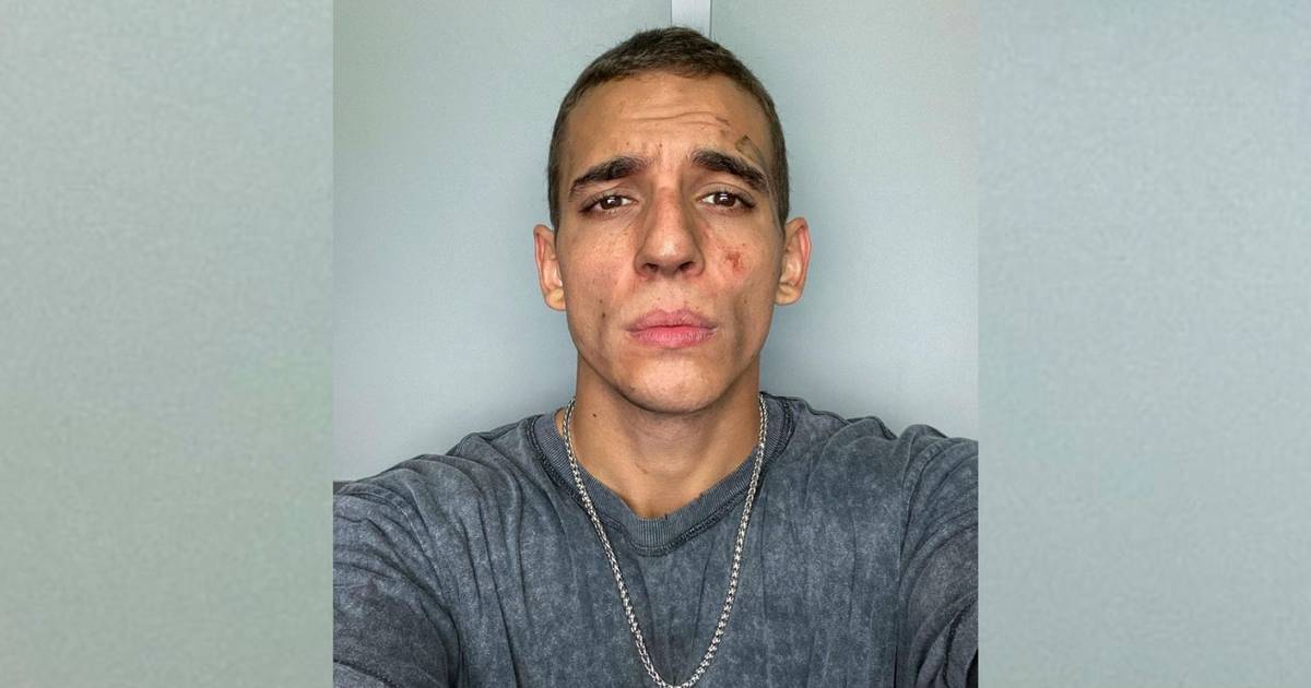 Miguel Herrán, actor de ‘La Casa de Papel’, habla del incendio que sufrió su casa