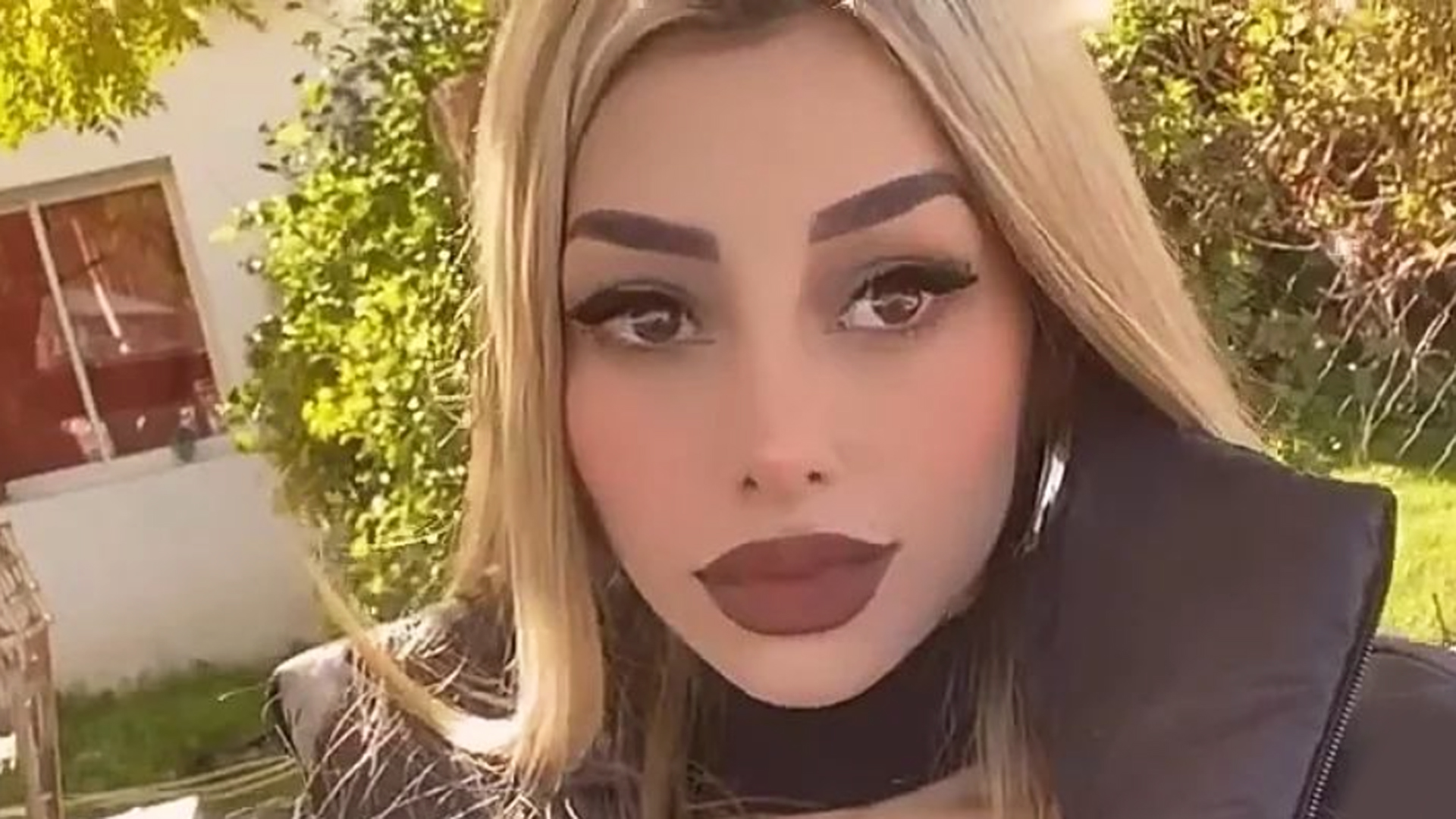 Tamara Baéz se hizo un retoque estético y lo celebró en las redes: “Me animé”