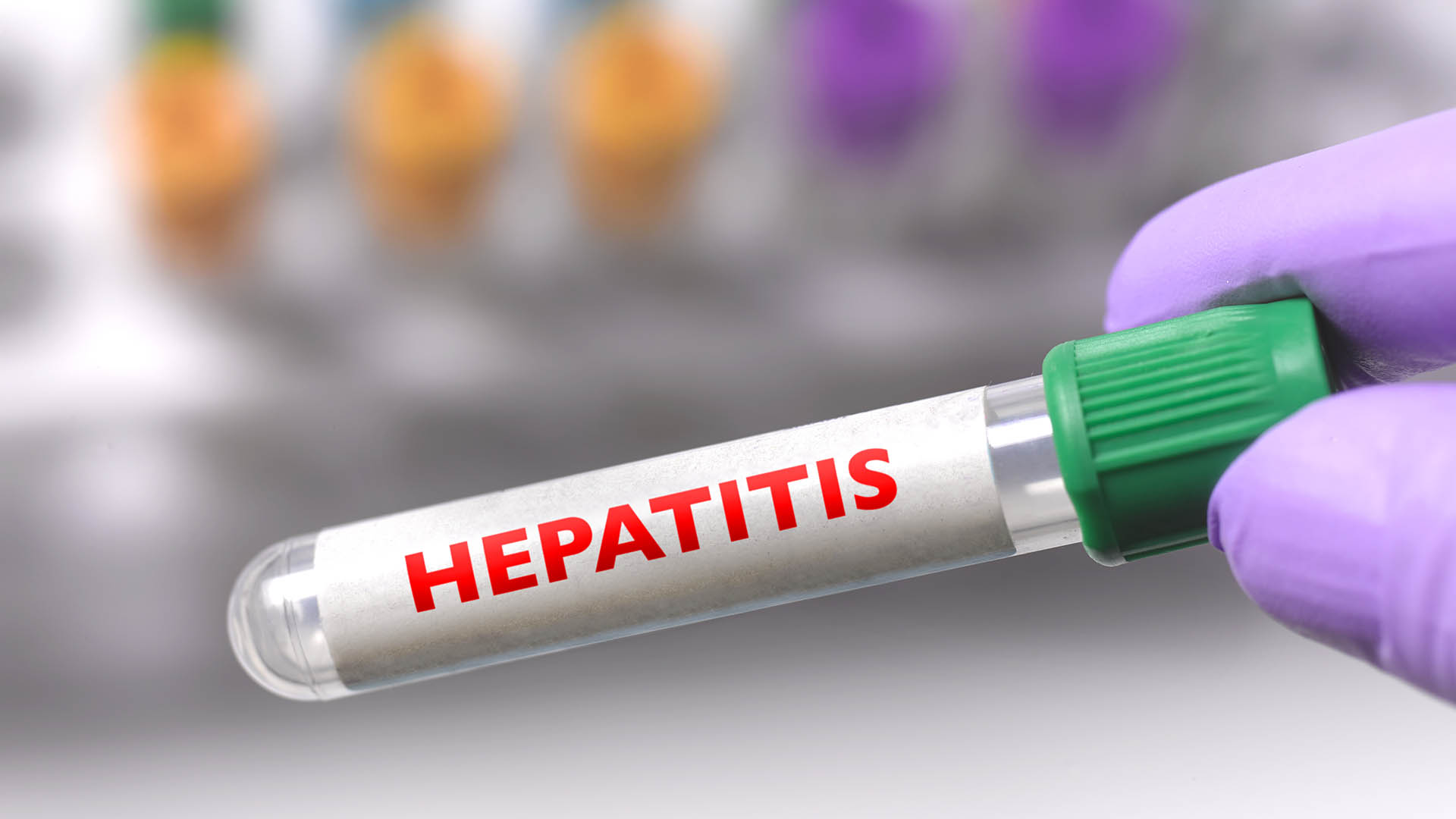 Recientemente se detectaron varios casos de hepatitis (Getty Images)