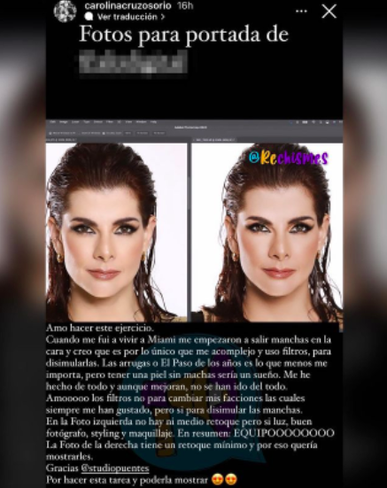 Carolina Cruz reveló los motivos por los que prefiere utilizar filtros en sus fotos de redes sociales. Tomada de Instagram @rechismes