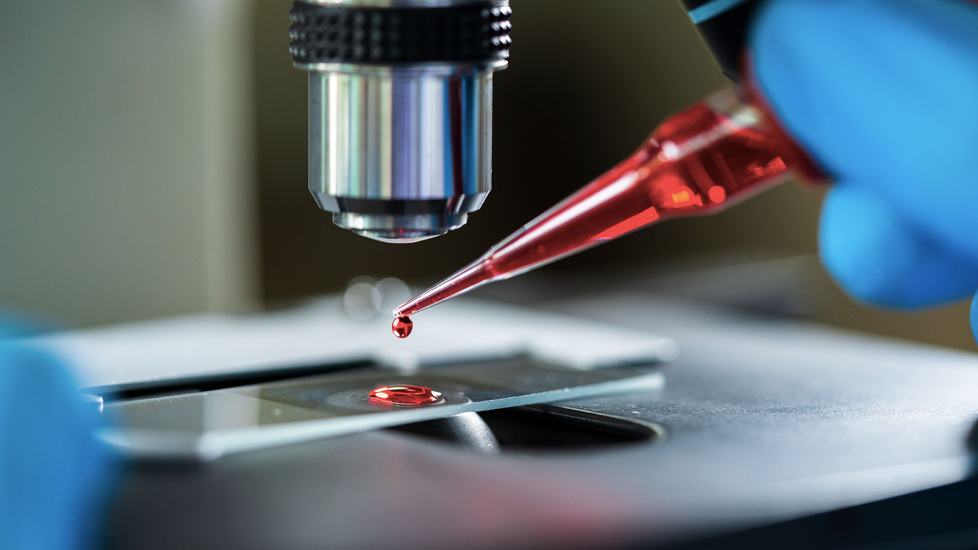 Los avances en el conocimiento del ADN se aplican de dos formas: en el diagnóstico del tumor y en el tratamiento dirigido al subtipo molecular del cáncer a tratar (Gettyimages)