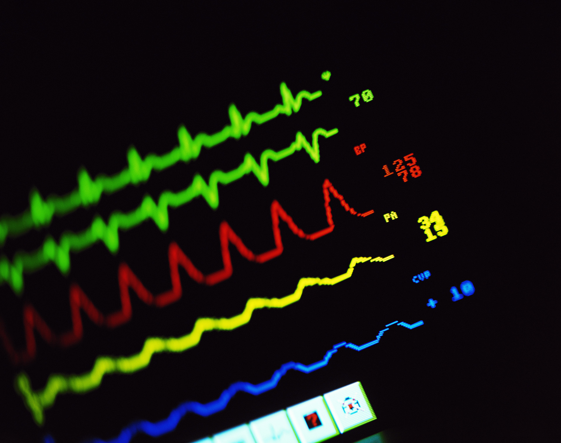 La hipertensión es una enfermedad que constituye la principal causa de muerte y discapacidad en el mundo, explicaron desde SAHA